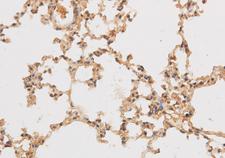 SF3A3 / SF3a60 Antibody - Immunohistochemistry of paraffin-embedded Rat lung using SF3A3 Polyclonal Antibody at dilution of 1:50.