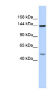 SF3B1 Antibody - SF3B1 antibody Western blot of HeLa lysate. This image was taken for the unconjugated form of this product. Other forms have not been tested.