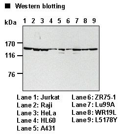 SF3B1 Antibody