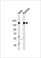 SF3B1 Antibody - All lanes : Anti-SAP155 Antibody at 1:1000 dilution Lane 1: HeLa whole cell lysates Lane 2: Ramos whole cell lysates Lysates/proteins at 20 ug per lane. Secondary Goat Anti-Rabbit IgG, (H+L),Peroxidase conjugated at 1/10000 dilution Predicted band size : 146 kDa Blocking/Dilution buffer: 5% NFDM/TBST.