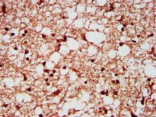 SF3B1 Antibody - Immunohistochemistry Dilution at 1:200 and staining in paraffin-embedded human brain tissue performed on a Leica BondTM system. After dewaxing and hydration, antigen retrieval was mediated by high pressure in a citrate buffer (pH 6.0). Section was blocked with 10% normal Goat serum 30min at RT. Then primary antibody (1% BSA) was incubated at 4°C overnight. The primary is detected by a biotinylated Secondary antibody and visualized using an HRP conjugated SP system.