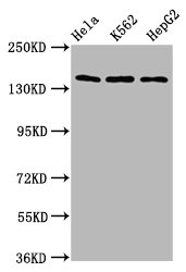 SF3B1 Antibody - Western Blot Positive WB detected in: Hela whole cell lysate, K562 whole cell lysate, HepG2 whole cell lysate All Lanes: SF3B1 antibody at 9.8µg/ml Secondary Goat polyclonal to rabbit IgG at 1/50000 dilution Predicted band size: 146, 17 KDa Observed band size: 146 KDa