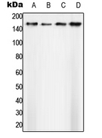 SF3B1 Antibody - Western blot analysis of SAP155 expression in A431 (A); Ramos (B); SP2/0 (C); H9C2 (D) whole cell lysates.