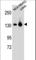 SF3B130 / SF3B3 Antibody - SF3B3 Antibody western blot of MDA-MB453,Jurkat cell line lysates (35 ug/lane). The SF3B3 antibody detected the SF3B3 protein (arrow).