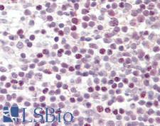 SF3B130 / SF3B3 Antibody - Human Tonsil: Formalin-Fixed, Paraffin-Embedded (FFPE).  This image was taken for the unconjugated form of this product. Other forms have not been tested.