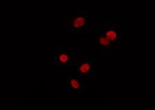 SF3B130 / SF3B3 Antibody - Staining HeLa cells by IF/ICC. The samples were fixed with PFA and permeabilized in 0.1% Triton X-100, then blocked in 10% serum for 45 min at 25°C. The primary antibody was diluted at 1:200 and incubated with the sample for 1 hour at 37°C. An Alexa Fluor 594 conjugated goat anti-rabbit IgG (H+L) Ab, diluted at 1/600, was used as the secondary antibody.