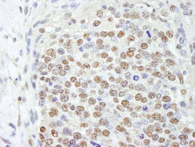 SF3B2 Antibody - Detection of Mouse SF3b145/SAP145 by Immunohistochemistry. Sample: FFPE section of mouse teratoma. Antibody: Affinity purified rabbit anti-SF3b145/SAP145 used at a dilution of 1:250.
