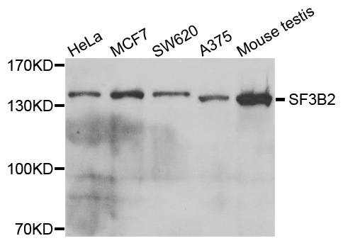 SF3B2 Antibody - Western blot analysis of extracts of various cells.