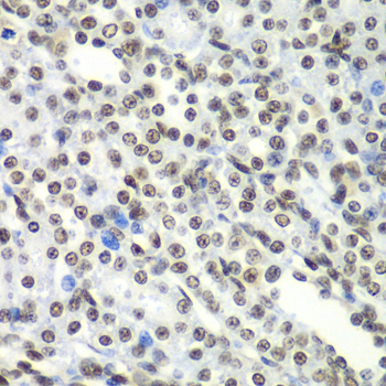 SF3B2 Antibody - Immunohistochemistry of paraffin-embedded rat kidney tissue.