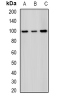 SF3B2 Antibody - Western blot analysis of SAP145 expression in HeLa (A); MCF7 (B); mouse testis (C) whole cell lysates.