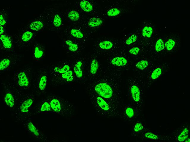 SF3B2 Antibody - Immunofluorescence staining of SF3B2 in U2OS cells. Cells were fixed with 4% PFA, permeabilzed with 0.1% Triton X-100 in PBS, blocked with 10% serum, and incubated with rabbit anti-Human SF3B2 polyclonal antibody (dilution ratio 1:200) at 4°C overnight. Then cells were stained with the Alexa Fluor 488-conjugated Goat Anti-rabbit IgG secondary antibody (green). Positive staining was localized to Nucleus.