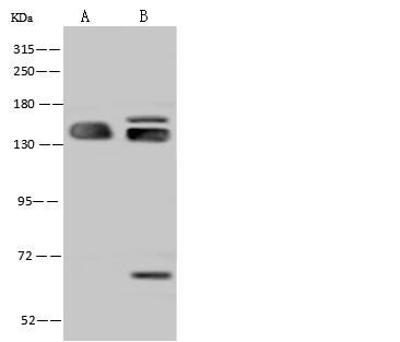 SF3B2 Antibody - Anti-SF3B2 rabbit polyclonal antibody at 1:500 dilution. Lane A: Hela Whole Cell Lysate. Lane B: U-251 MG Whole Cell Lysate. Lysates/proteins at 30 ug per lane. Secondary: Goat Anti-Rabbit IgG (H+L)/HRP at 1/10000 dilution. Developed using the ECL technique. Performed under reducing conditions. Predicted band size: 100 kDa. Observed band size: 140 kDa.