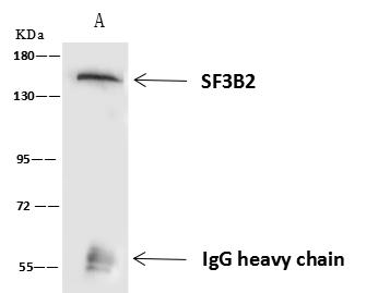 SF3B2 Antibody - SF3B2 was immunoprecipitated using: Lane A: 0.5 mg HeLa Whole Cell Lysate. 4 uL anti-SF3B2 rabbit polyclonal antibody and 60 ug of Immunomagnetic beads Protein A/G. Primary antibody: Anti-SF3B2 rabbit polyclonal antibody, at 1:100 dilution. Secondary antibody: Goat Anti-Rabbit IgG (H+L)/HRP at 1/10000 dilution. Developed using the ECL technique. Performed under reducing conditions. Predicted band size: 100 kDa. Observed band size: 150 kDa.