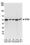 SF3B4 Antibody - Detection of Human and Mouse SF3B4 by Western Blot. Samples: Whole cell lysate from 293T (15 and 50 ug), HeLa (50 ug), Jurkat (50 ug), and mouse NIH3T3 (50 ug) cells. Antibodies: Affinity purified rabbit anti-SF3B4 antibody used for WB at 0.1 ug/ml. Detection: Chemiluminescence with an exposure time of 10 seconds.