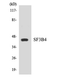 SF3B4 Antibody - Western blot analysis of the lysates from 293 cells using SF3B4 antibody.