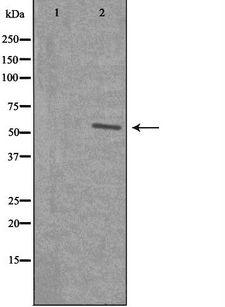 SF3B4 Antibody - Western blot analysis of extracts of K562 cells using SF3B4 antibody. The lane on the left is treated with the antigen-specific peptide.