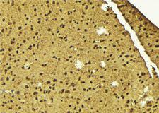 SF3B4 Antibody - 1:100 staining mouse brain tissue by IHC-P. The sample was formaldehyde fixed and a heat mediated antigen retrieval step in citrate buffer was performed. The sample was then blocked and incubated with the antibody for 1.5 hours at 22°C. An HRP conjugated goat anti-rabbit antibody was used as the secondary.