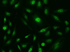 SF3B4 Antibody - Immunofluorescence staining of SF3B4 in HeLa cells. Cells were fixed with 4% PFA, permeabilzed with 0.1% Triton X-100 in PBS, blocked with 10% serum, and incubated with rabbit anti-Human SF3B4 polyclonal antibody (dilution ratio 1:100) at 4°C overnight. Then cells were stained with the Alexa Fluor 488-conjugated Goat Anti-rabbit IgG secondary antibody (green). Positive staining was localized to Nucleus.