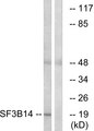 SF3B6 / SF3B14 Antibody - Western blot analysis of lysates from HepG2 cells, using SF3B14 Antibody. The lane on the right is blocked with the synthesized peptide.