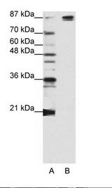 SF3B6 / SF3B14 Antibody - A: Marker, B: Jurkat Cell Lysate.  This image was taken for the unconjugated form of this product. Other forms have not been tested.