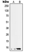 SF3B6 / SF3B14 Antibody - Western blot analysis of SAP14 expression in HepG2 (A); RT4 (B) whole cell lysates.