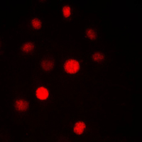 SF3B6 / SF3B14 Antibody - Immunofluorescent analysis of SAP14 staining in HepG2 cells. Formalin-fixed cells were permeabilized with 0.1% Triton X-100 in TBS for 5-10 minutes and blocked with 3% BSA-PBS for 30 minutes at room temperature. Cells were probed with the primary antibody in 3% BSA-PBS and incubated overnight at 4 C in a humidified chamber. Cells were washed with PBST and incubated with a DyLight 594-conjugated secondary antibody (red) in PBS at room temperature in the dark. DAPI was used to stain the cell nuclei (blue).