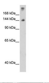 SF3B6 / SF3B14 Antibody - Fetal Thymus Lysate.  This image was taken for the unconjugated form of this product. Other forms have not been tested.