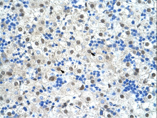 SF3B6 / SF3B14 Antibody - SF3B1 antibody ARP40249_T100-NP_036565-SF3B1(splicing factor 3b, subunit 1, 155kDa) Antibody was used in IHC to stain formalin-fixed, paraffin-embedded human liver.  This image was taken for the unconjugated form of this product. Other forms have not been tested.