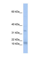 SF3B6 / SF3B14 Antibody - SF3B14 antibody Western blot of THP-1 cell lysate. This image was taken for the unconjugated form of this product. Other forms have not been tested.
