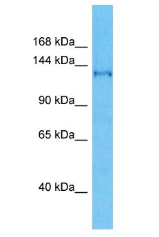 SFI1 Antibody - SFI1 antibody Western Blot of Jurkat. Antibody dilution: 1 ug/ml.  This image was taken for the unconjugated form of this product. Other forms have not been tested.