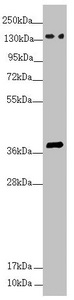 SFI1 Antibody - Western blot All Lanes:SFI1 antibody at 4.26 ug/ml+ HepG-2 whole cell lysate Secondary Goat polyclonal to rabbit IgG at 1/10000 dilution Predicted band size: 148,144,139,122,118,142,137 kDa Observed band size: 148,38 kDa