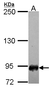 SFMBT1 Antibody - Sample (30 ug of whole cell lysate). A: IMR32. 7.5% SDS PAGE. SFMBT1 antibody diluted at 1:3000.