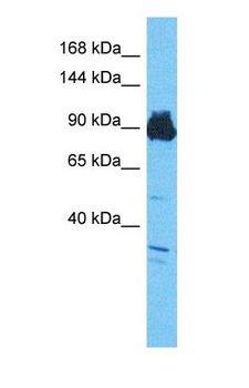 SFMBT1 Antibody - Western blot of SMBT1 Antibody with human Jurkat Whole Cell lysate.  This image was taken for the unconjugated form of this product. Other forms have not been tested.