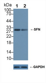 SFN / Stratifin / 14-3-3 Sigma Antibody - Knockout Varification: Lane 1: Wild-type Hela cell lysate; Lane 2: SFN knockout Hela cell lysate; Predicted MW: 28kd Observed MW: 30kd Primary Ab: 1µg/ml Rabbit Anti-Human SFN Antibody Second Ab: 0.2µg/mL HRP-Linked Caprine Anti-Rabbit IgG Polyclonal Antibody