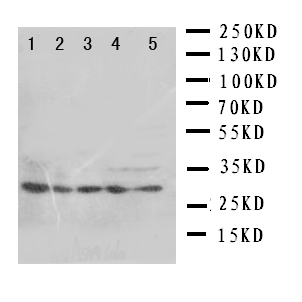 SFN / Stratifin / 14-3-3 Sigma Antibody - WB of SFN / Stratifin / 14-3-3 Sigma antibody. Lane 1: HELA Cell Lysate. Lane 2: A549 Cell Lysate. Lane 3: A549 Cell Lysate. Lane 4: COLO320 Cell Lysate. Lane 5: SE620 Cell Lysate.