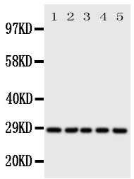 SFN / Stratifin / 14-3-3 Sigma Antibody - Anti-14-3-3 sigma antibody, Western blotting All lanes: Anti 14-3-3 sigma at 0.5ug/ml Lane 1: HELA Whole Cell Lysate at 40ug Lane 2: A549 Whole Cell Lysate at 40ug Lane 3: A549 Whole Cell Lysate at 40ug Lane 4: COLO320 Whole Cell Lysate at 40ug Lane 5: SE620 Whole Cell Lysate at 40ug Predicted bind size: 28KD Observed bind size: 28KD