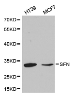 SFN / Stratifin / 14-3-3 Sigma Antibody - Western blot of extracts of various cell lines, using SFN antibody.