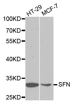 SFN / Stratifin / 14-3-3 Sigma Antibody - Western blot analysis of extracts of various cell lines, using SFN antibody at 1:1000 dilution. The secondary antibody used was an HRP Goat Anti-Rabbit IgG (H+L) at 1:10000 dilution. Lysates were loaded 25ug per lane and 3% nonfat dry milk in TBST was used for blocking.
