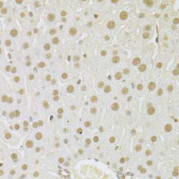SFN / Stratifin / 14-3-3 Sigma Antibody - Immunohistochemistry of paraffin-embedded mouse liver using SFN Antibodyat dilution of 1:100 (40x lens).
