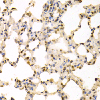 SFN / Stratifin / 14-3-3 Sigma Antibody - Immunohistochemistry of paraffin-embedded rat lung using SFN Antibodyat dilution of 1:100 (40x lens).