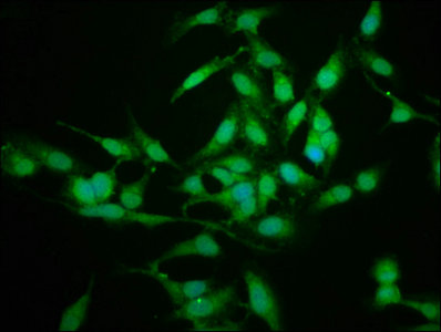 SFN / Stratifin / 14-3-3 Sigma Antibody - Immunofluorescence staining of Hela cells with SFN Antibody at 1:225, counter-stained with DAPI. The cells were fixed in 4% formaldehyde, permeabilized using 0.2% Triton X-100 and blocked in 10% normal Goat Serum. The cells were then incubated with the antibody overnight at 4°C. The secondary antibody was Alexa Fluor 488-congugated AffiniPure Goat Anti-Rabbit IgG(H+L).