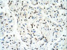 SFPQ Antibody - SFPQ antibody ARP40571_T100-NP_005057-SFPQ(splicing factor proline/glutamine-rich) Antibody was used in IHC to stain formalin-fixed, paraffin-embedded human muscle.  This image was taken for the unconjugated form of this product. Other forms have not been tested.