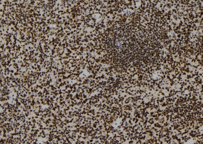 SFPQ Antibody - 1:100 staining mouse spleen tissue by IHC-P. The sample was formaldehyde fixed and a heat mediated antigen retrieval step in citrate buffer was performed. The sample was then blocked and incubated with the antibody for 1.5 hours at 22°C. An HRP conjugated goat anti-rabbit antibody was used as the secondary.