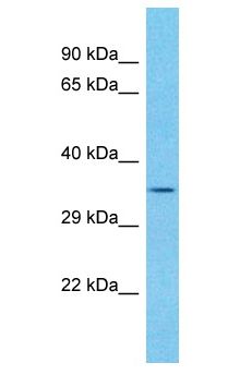 SFR1 / C10orf78 Antibody - SFR1 / C10orf78 antibody Western Blot of Jurkat. Antibody dilution: 1 ug/ml.  This image was taken for the unconjugated form of this product. Other forms have not been tested.