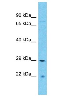SFR1 / C10orf78 Antibody - SFR1 / C10orf78 antibody Western Blot of COLO205. Antibody dilution: 1 ug/ml.  This image was taken for the unconjugated form of this product. Other forms have not been tested.