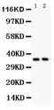 SFRP-3 / FRZB Antibody - FRZB antibody Western blot. All lanes: Anti FRZB at 0.5 ug/ml. Lane 1: PANC Whole Cell Lysate at 40 ug. Lane 2: U87 Whole Cell Lysate at 40 ug. Predicted band size: 36 kD. Observed band size: 36 kD.