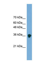 SFRP-3 / FRZB Antibody - FRZB antibody Western blot of Transfected 293T cell lysate. This image was taken for the unconjugated form of this product. Other forms have not been tested.