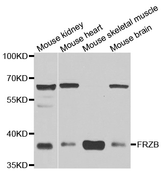 SFRP-3 / FRZB Antibody - Western blot analysis of extracts of various cell lines.