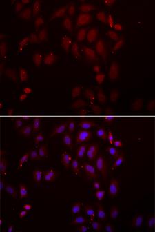 SFRP-3 / FRZB Antibody - Immunofluorescence analysis of A549 cells.