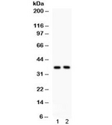 SFRP-3 / FRZB Antibody